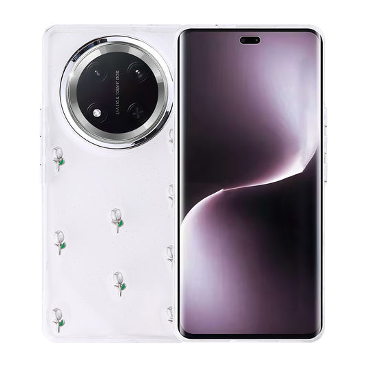 Honor Magic 7 Lite Case Airbag Design Glitter Transparent Zore Polar Cover Tulip