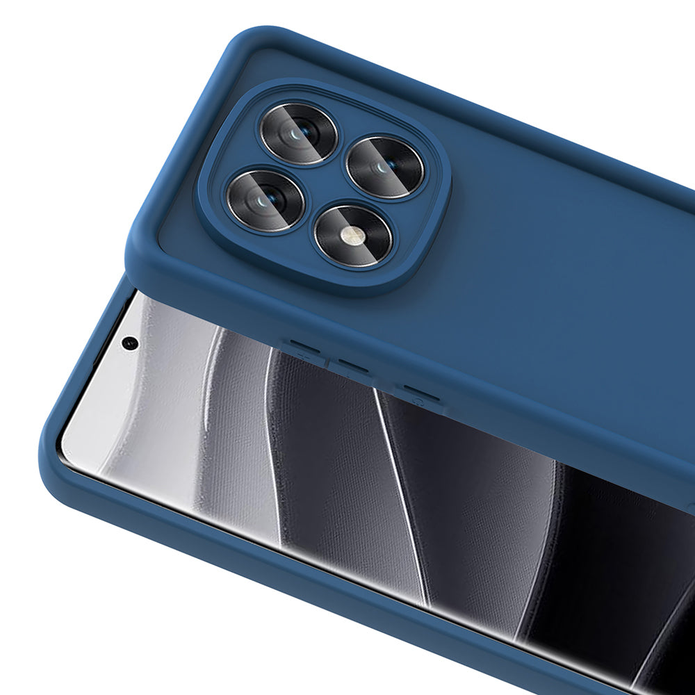 Xiaomi Redmi Note 14 Pro Plus Kılıf Kamera Korumalı Zore Ananas Kapak Mürdüm