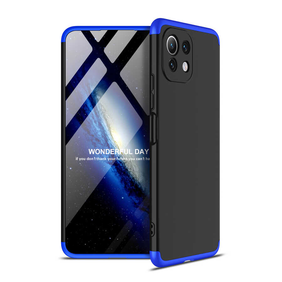 Xiaomi Mi 11 Lite Kılıf Zore Ays Kapak