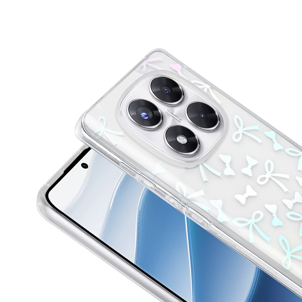 Xiaomi Redmi Note 14 Pro 4G Kılıf Şeffaf Figürlü Zore Folk Sert Kapak Sevimli Köpek